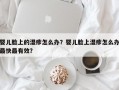 婴儿脸上的湿疹怎么办？婴儿脸上湿疹怎么办最快最有效？